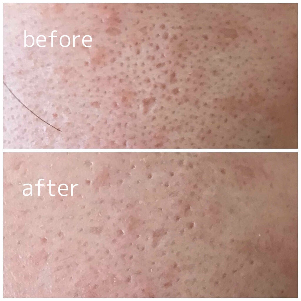 ポアカバー セラムスティック/ettusais/美容液を使ったクチコミ(3枚目)