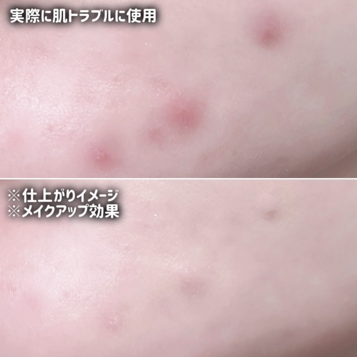 ダーマシンコンシーラー/23years old/リキッドコンシーラーを使ったクチコミ（3枚目）