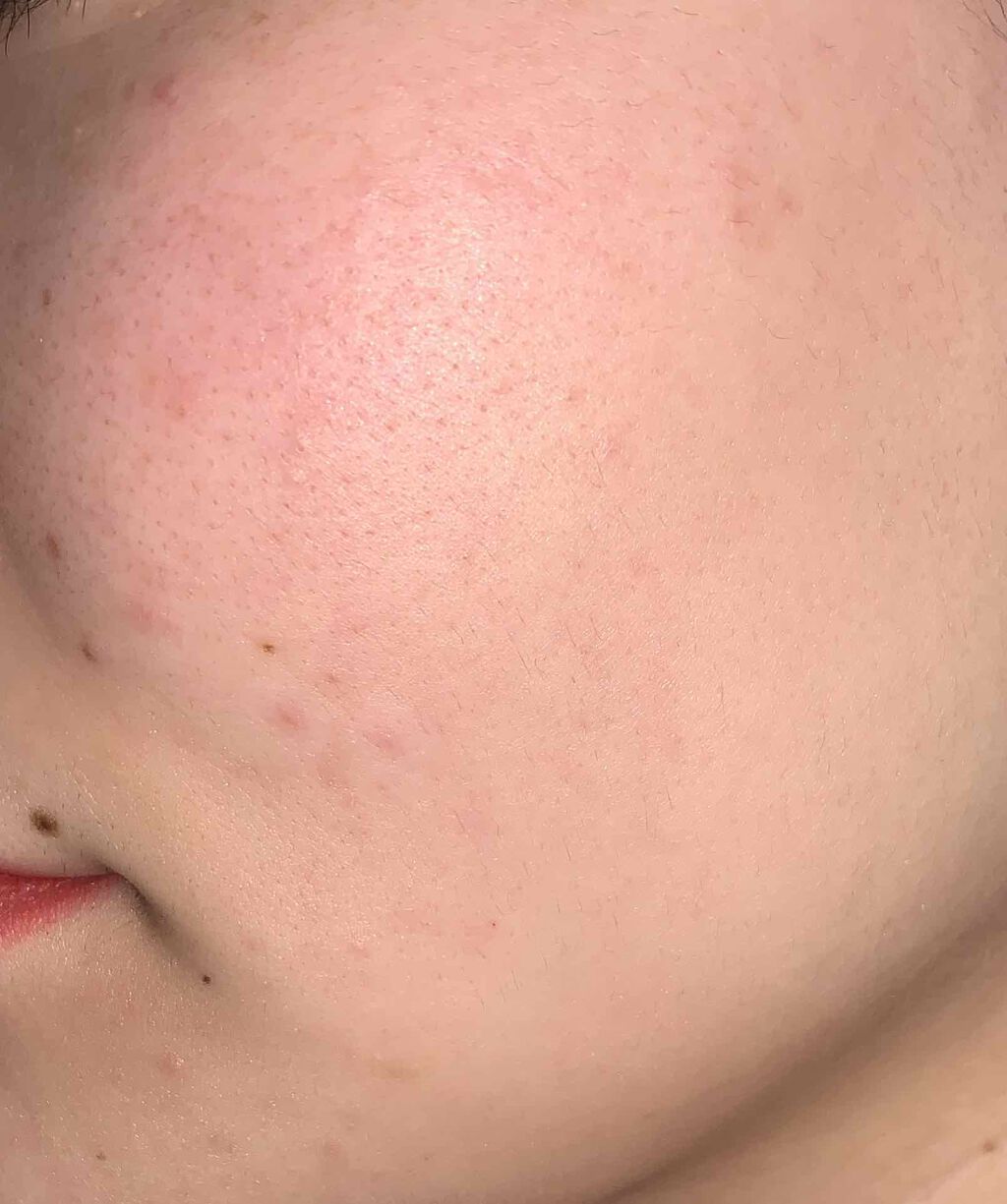 ゼロクッション 02 natural/rom&nd/クッションファンデーションを使ったクチコミ（3枚目）