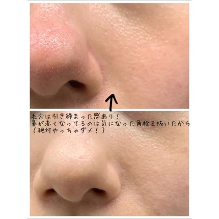 毛穴小町マスク		/クリアターン/シートマスク・パックを使ったクチコミ(3枚目)