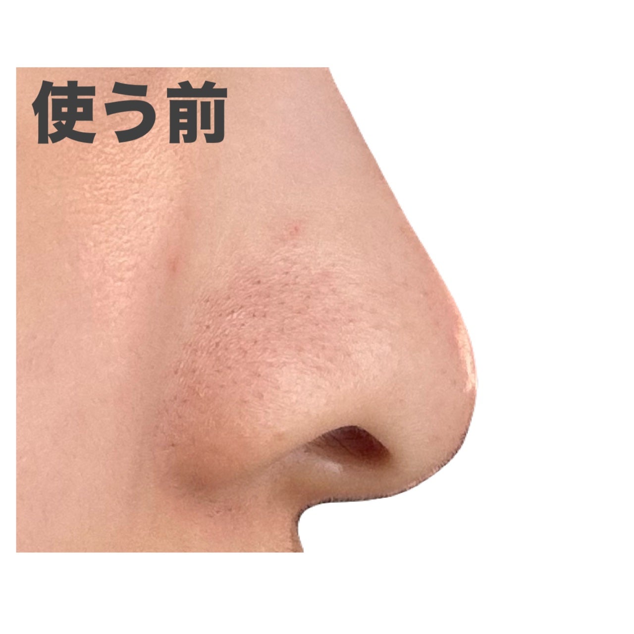 ゼロ毛穴パッド 2.0/MEDICUBE/トナーパッドを使ったクチコミ(6枚目)