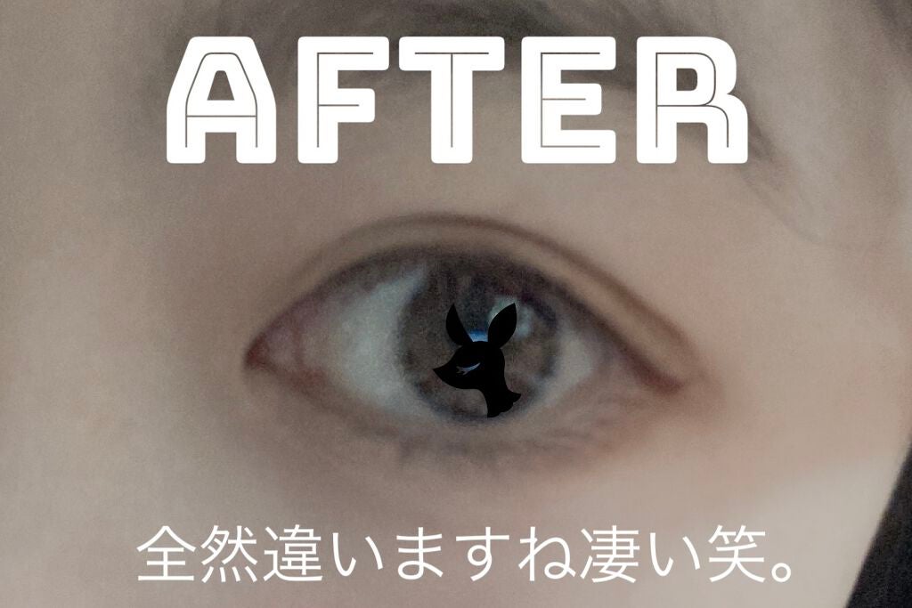 オリシキ アイリッドスキンフィルム /D-UP/二重まぶた用アイテムを使ったクチコミ(7枚目)