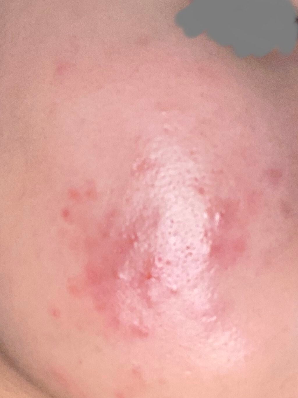 ACアクティブ トライアルセット/NOV/トライアルキットを使ったクチコミ(3枚目)