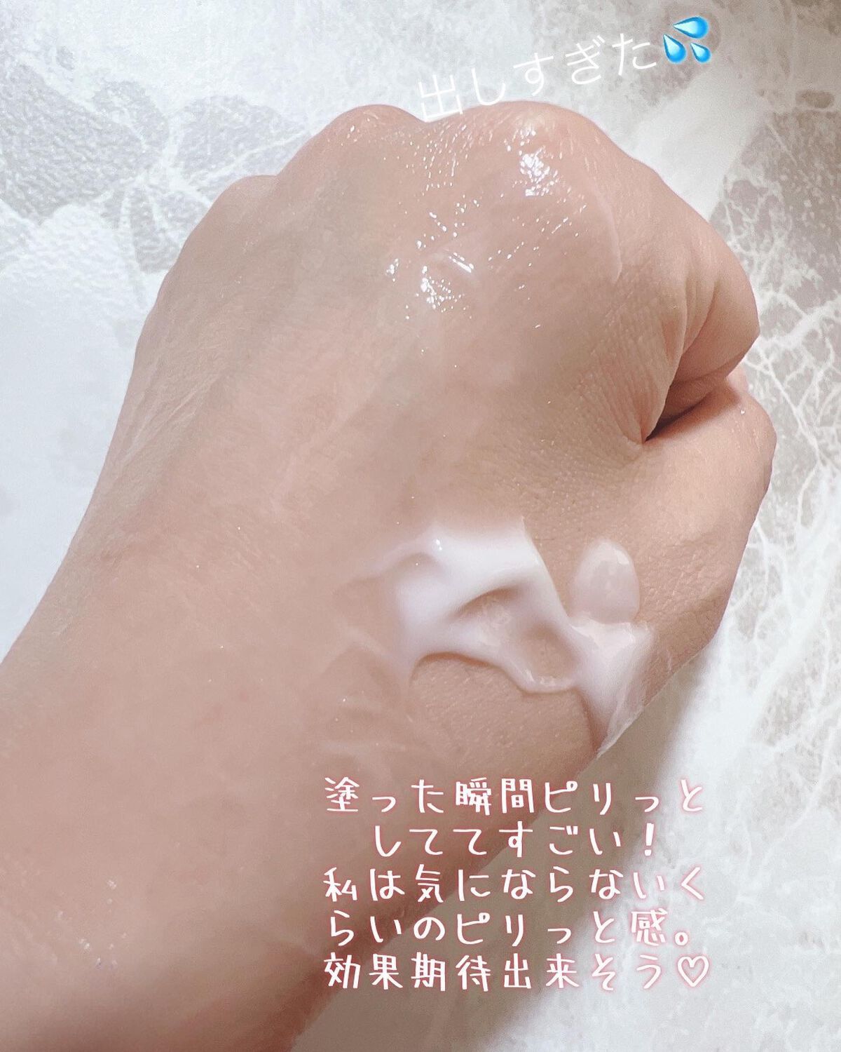 メディリフト ニードルリフトクリーム/YA-MAN TOKYO JAPAN/フェイスクリームを使ったクチコミ(3枚目)