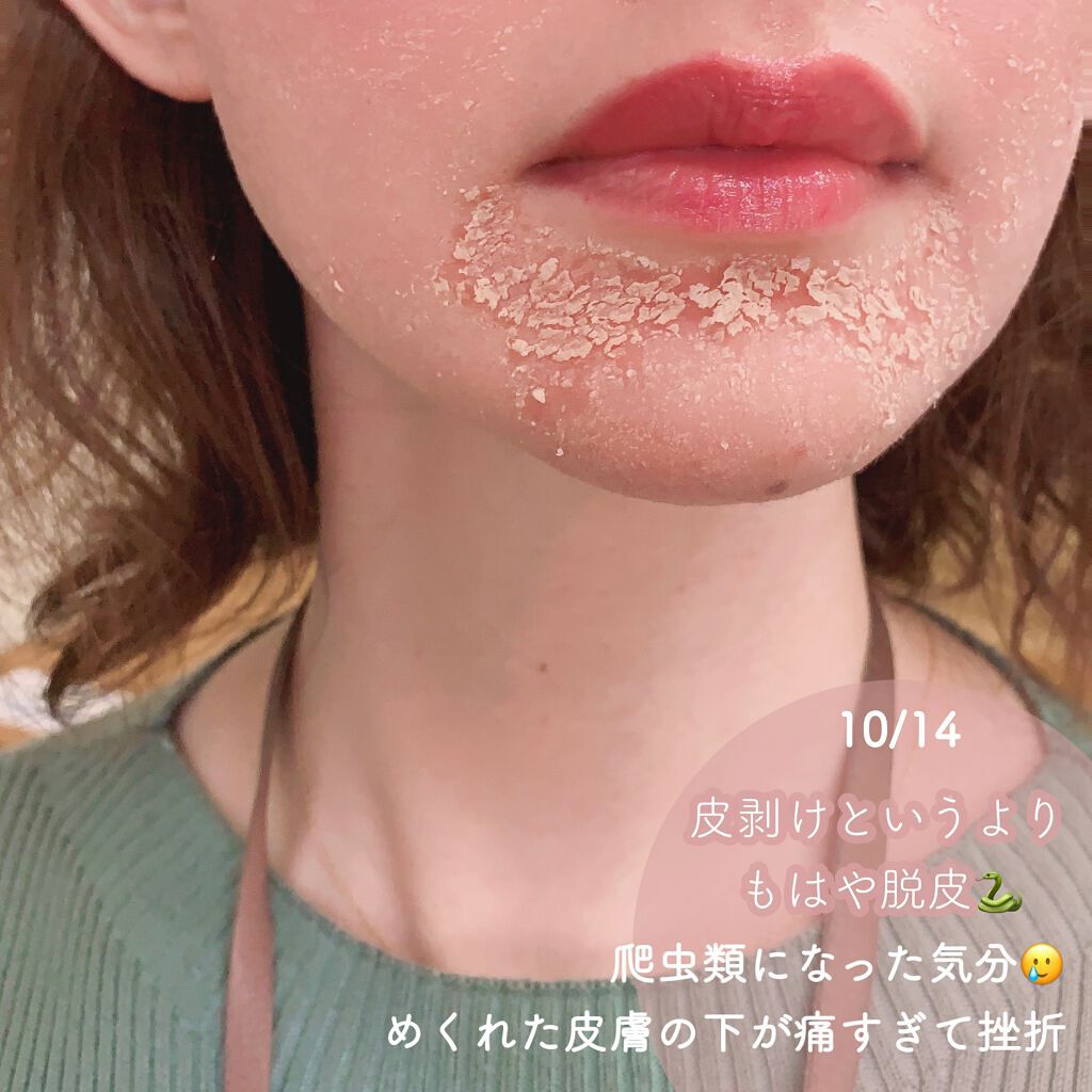 ゼオスキン ミラミン ミラミックス デイリーPD セラピューティック ミラミックス | ゼオスキンヘルス｜セイコメディカルビューティ