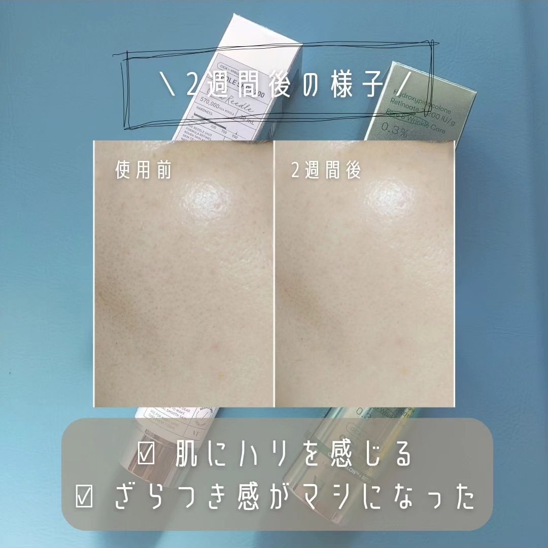 CICA デイリースージングマスク/VT/シートマスク・パックを使ったクチコミ(7枚目)