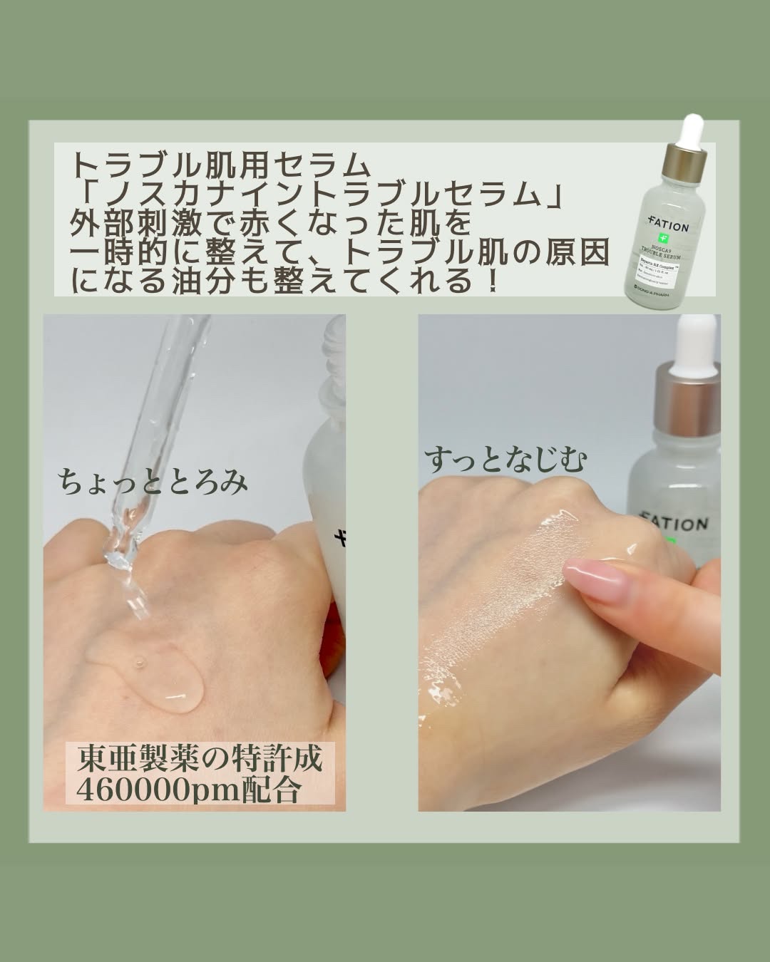 ノスカナイン トラブル セラム/FATION/美容液を使ったクチコミ（2枚目）