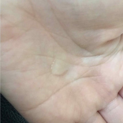 ホワイトショット CXS/ホワイトショット/美容液を使ったクチコミ(3枚目)