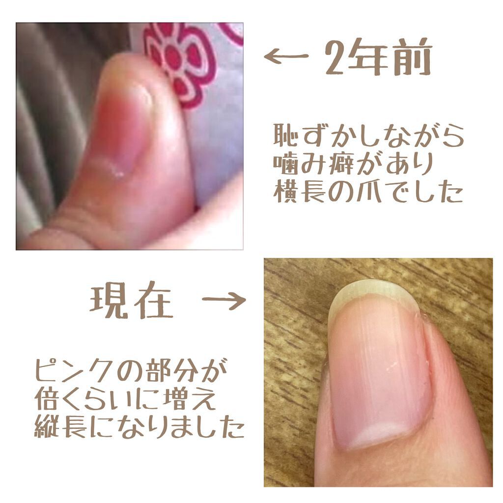 爪ミガキセット/デュカート/ネイル用品を使ったクチコミ(2枚目)