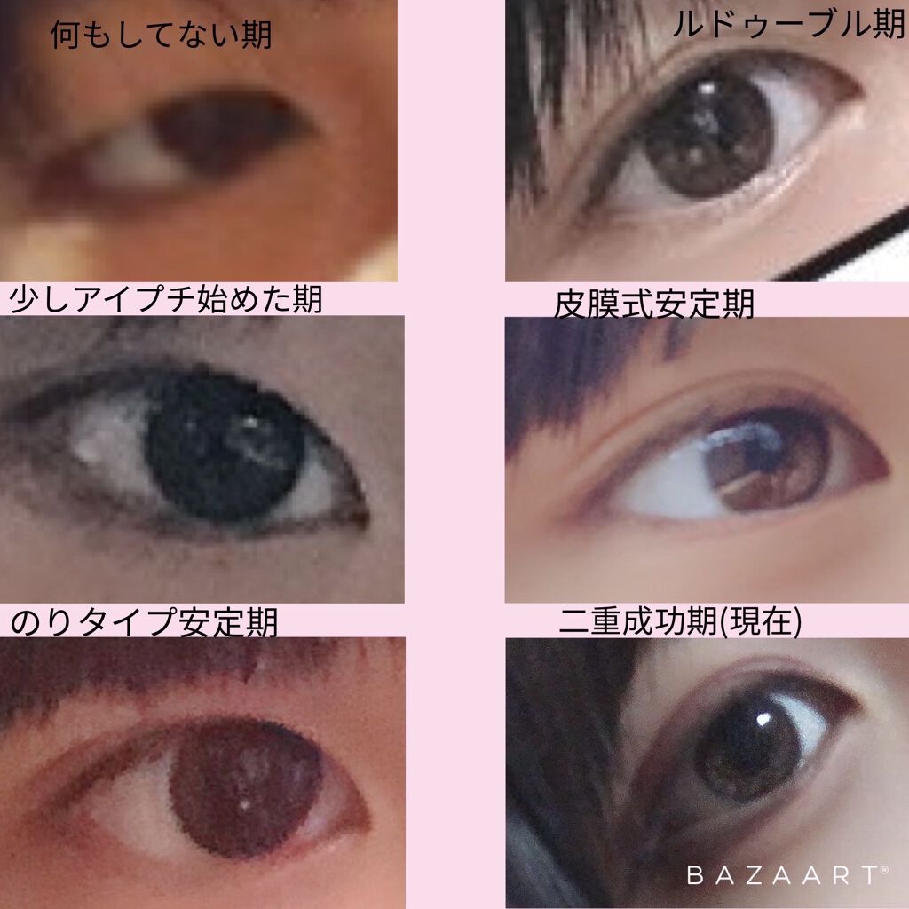 二重まぶた用シール/DAISO/二重まぶた用アイテムを使ったクチコミ（2枚目）