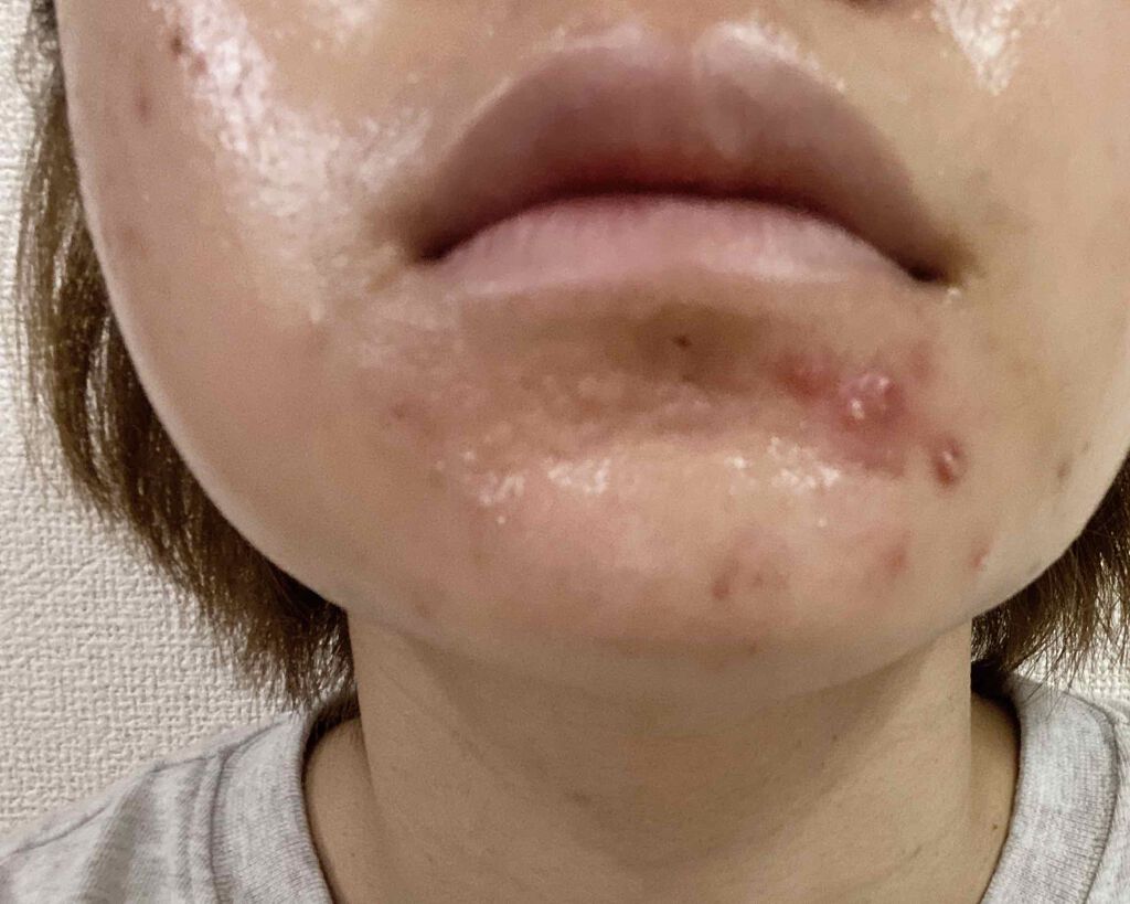 ザ・タイムR アクア/IPSA/化粧水を使ったクチコミ(2枚目)