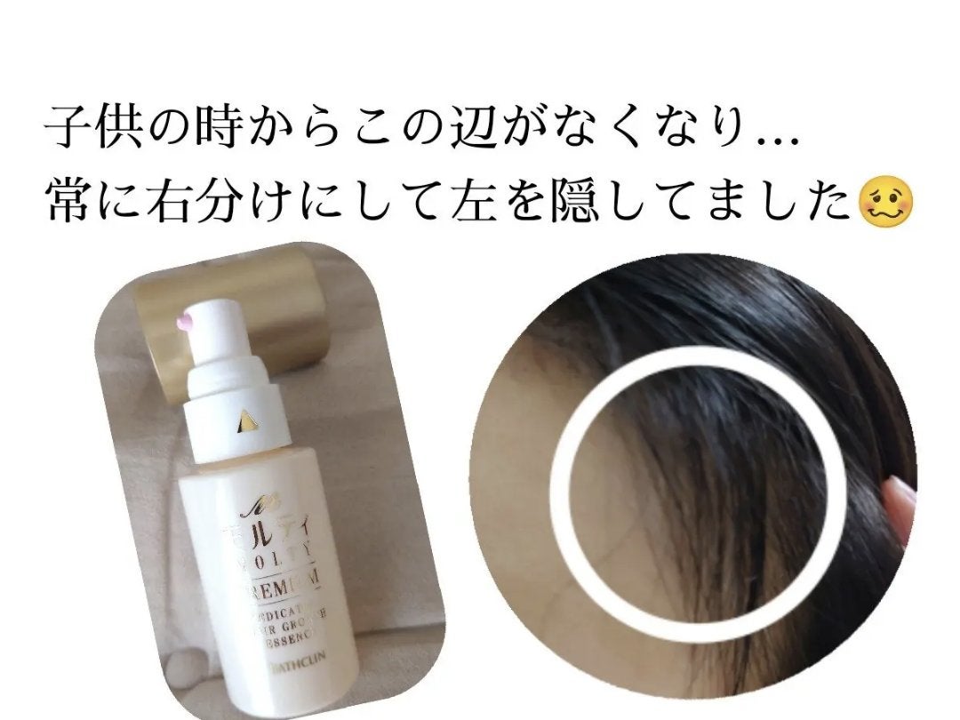 ヘアアクセルレーターEX フローラルアップルの香り/加美乃素本舗/頭皮ローションを使ったクチコミ(2枚目)