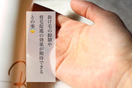 スカルプローション/Rintor/頭皮ローションを使ったクチコミ(4枚目)