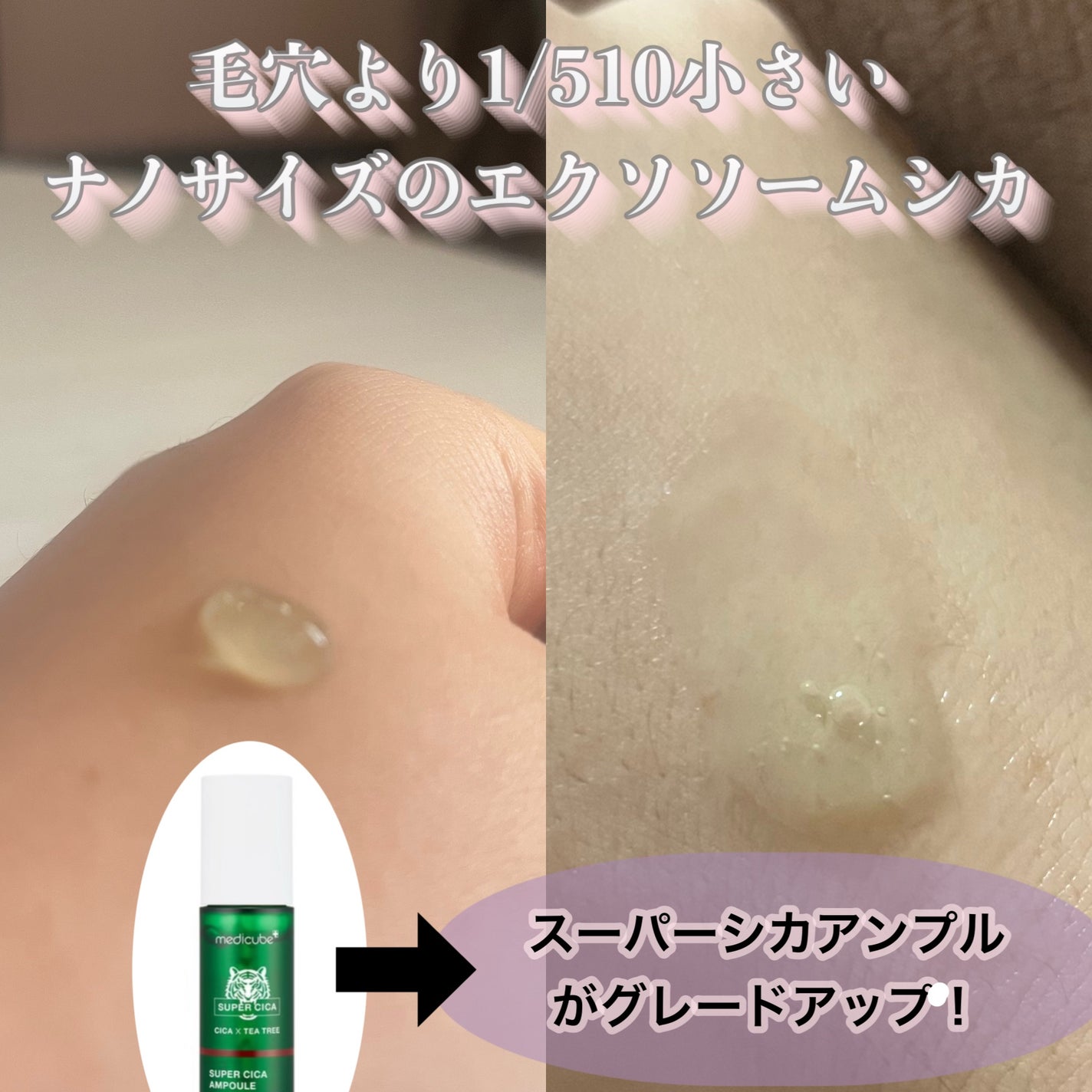 エクソソームシカ アンプル/MEDICUBE/美容液を使ったクチコミ(3枚目)