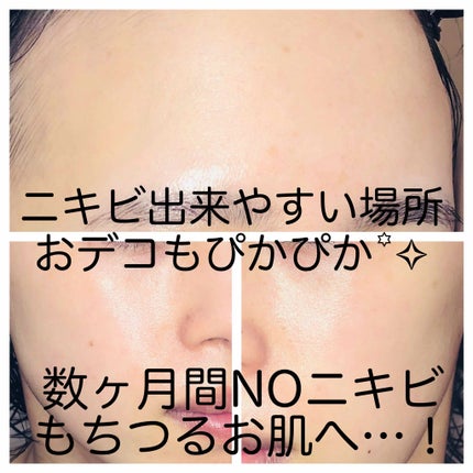 クレンジングバーム/ink./クレンジングバームを使ったクチコミ(1枚目)