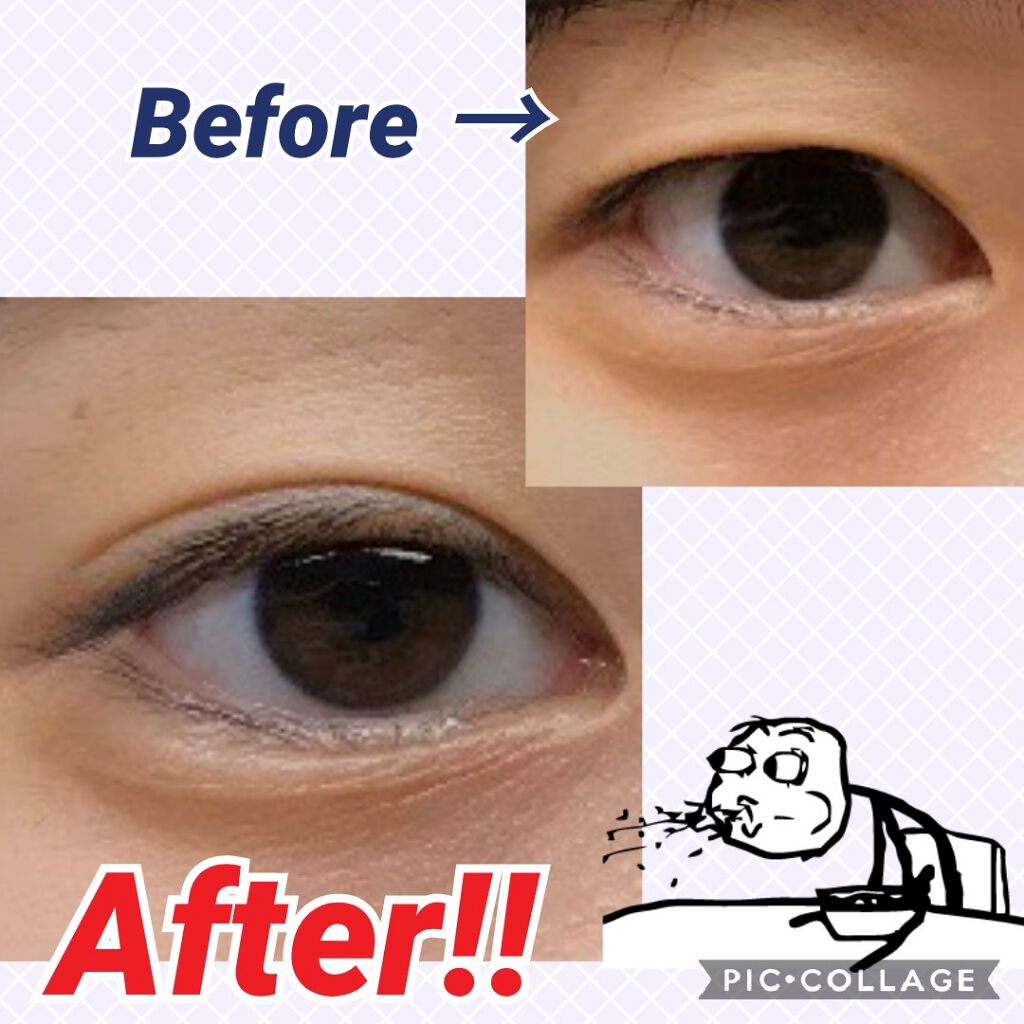 petitふたえリキッド/メザイク/二重まぶた用アイテムを使ったクチコミ（2枚目）