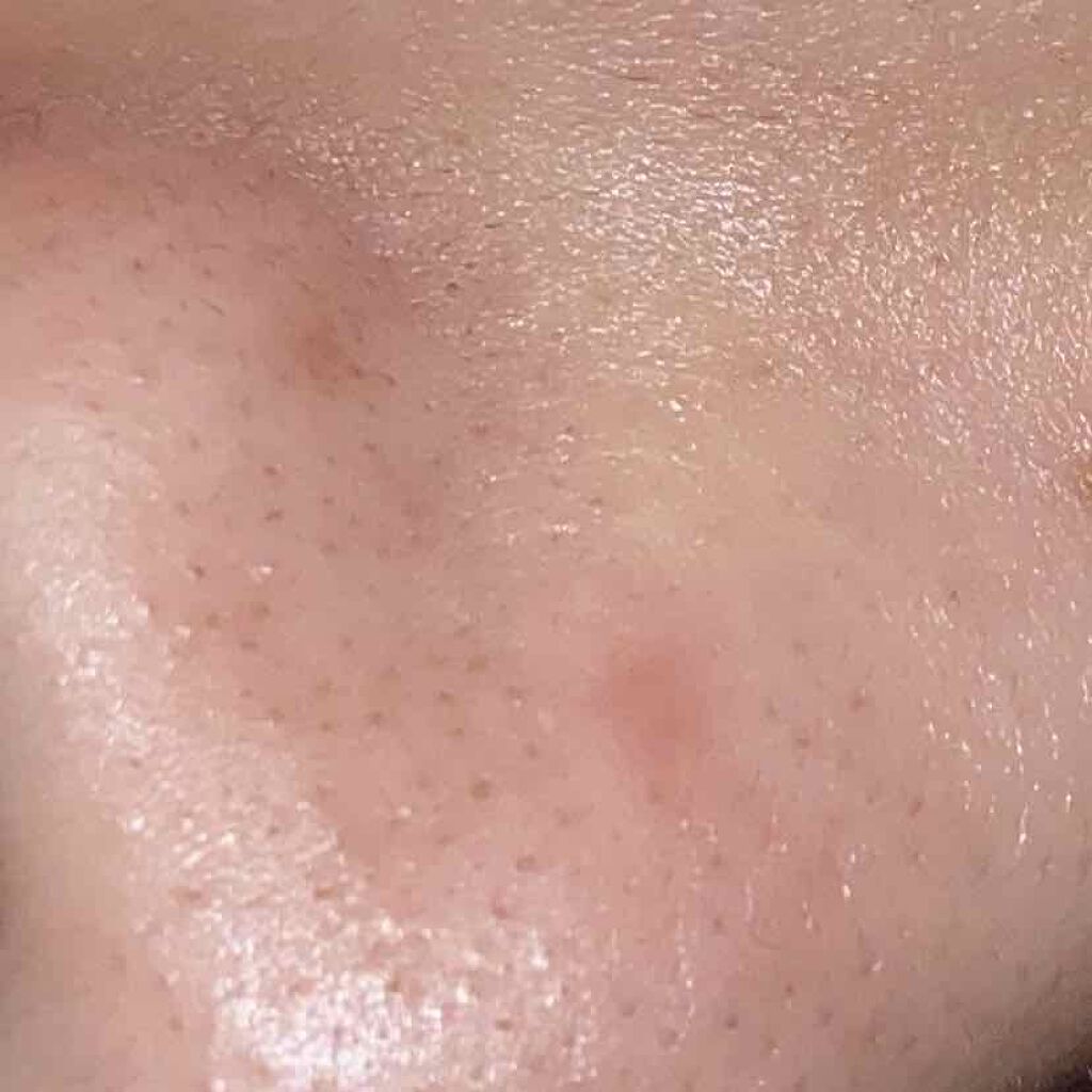 pink_gloss_oxxd on LIPS 「今大学一年生ですが、わたしは化粧品オタクでスキンケアから化粧品..」(2枚目)