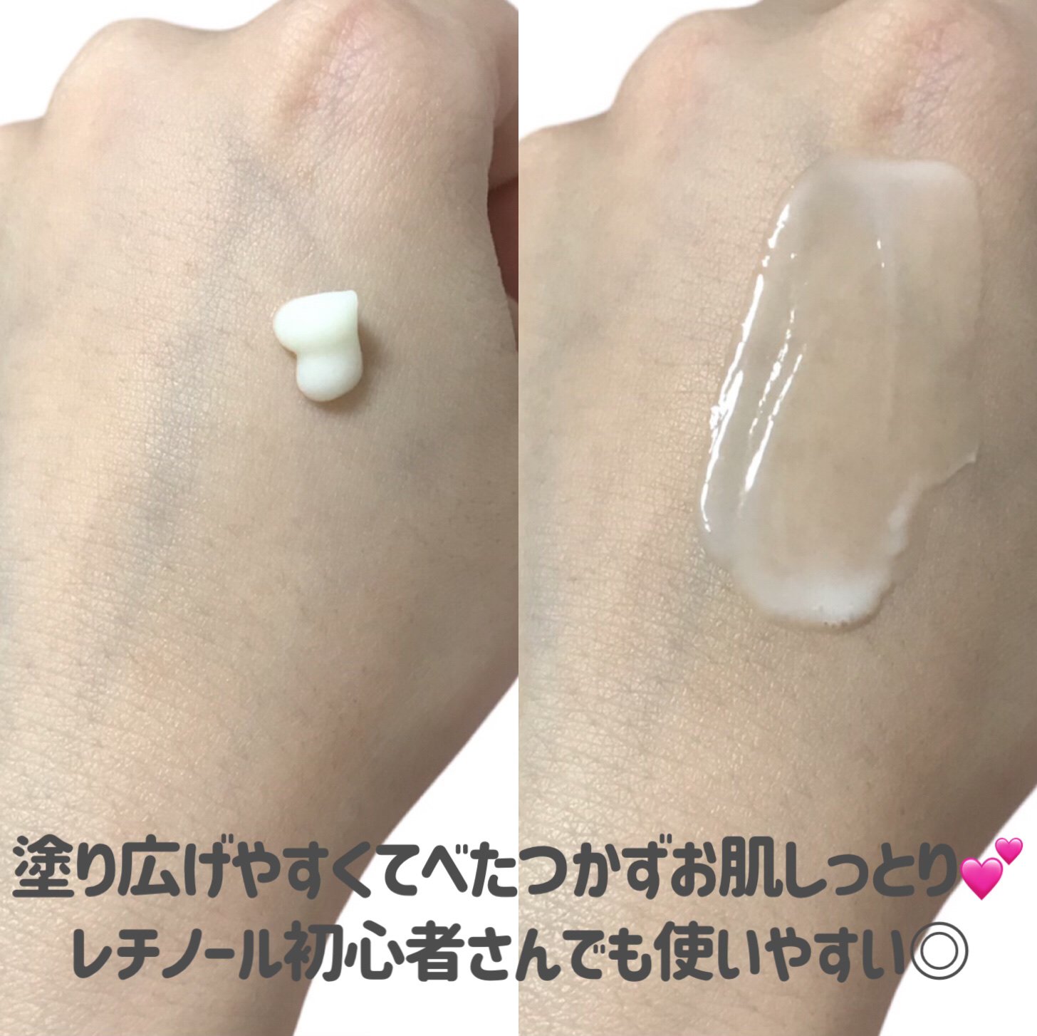 ボタレチノールユースリペアソリューションセット/ENPRANI（韓国）/美容液を使ったクチコミ（3枚目）