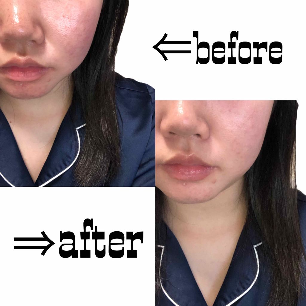 エテュセ ポアレスプライマー/ettusais/化粧下地を使ったクチコミ（3枚目）