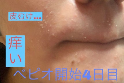 菊正宗 日本酒の化粧水 高保湿/菊正宗/化粧水を使ったクチコミ(5枚目)