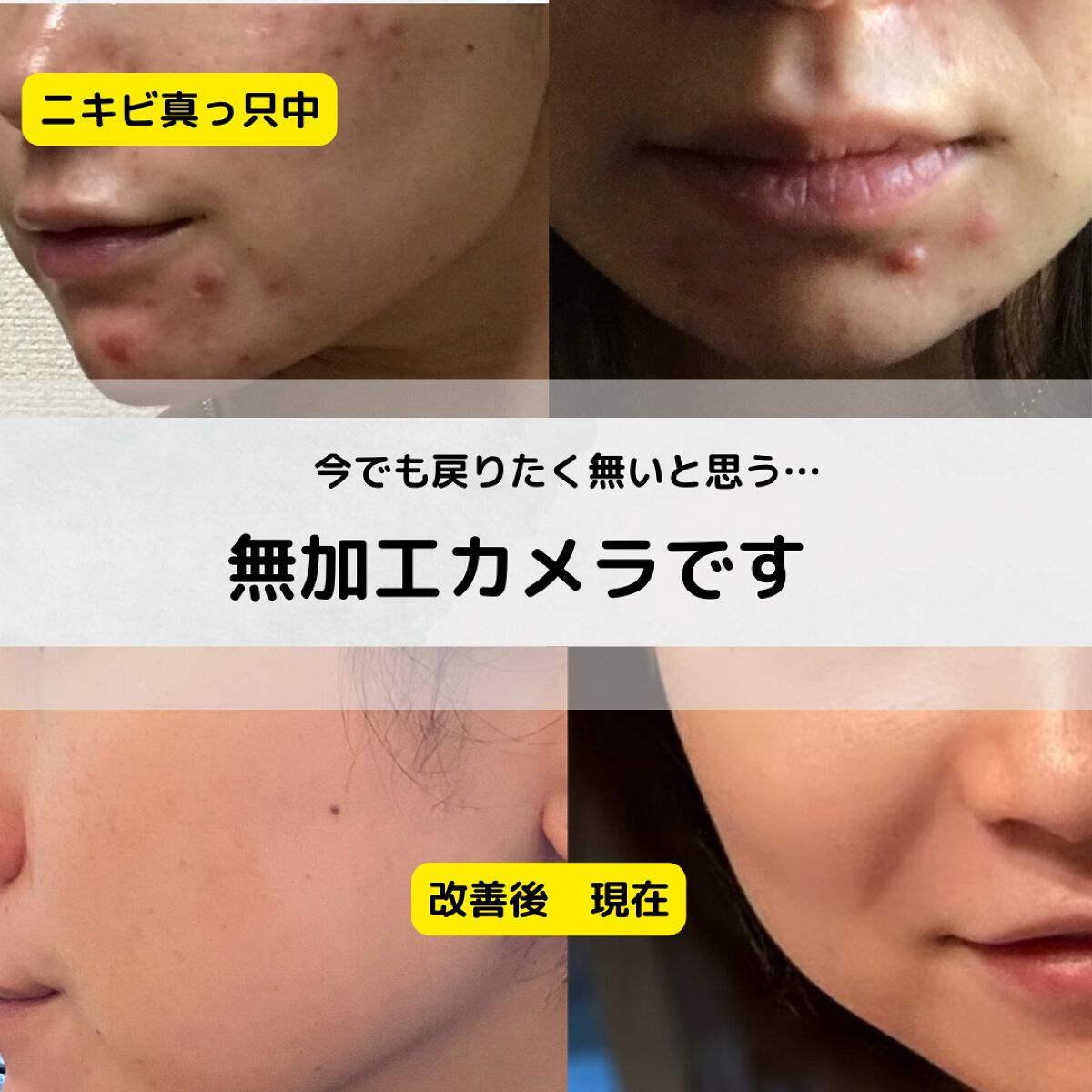 薬用ローション(しっとり)/IHADA/化粧水を使ったクチコミ(8枚目)