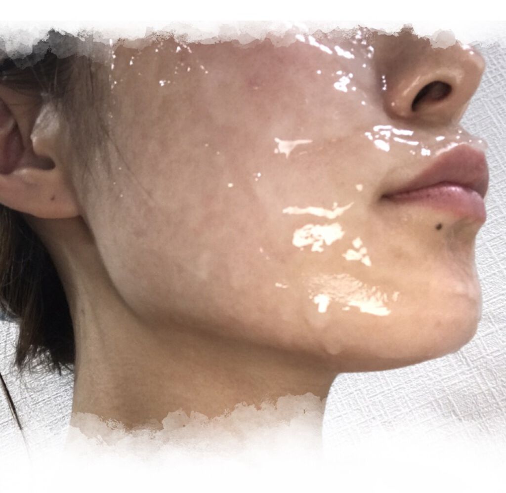 スパークリングパック/Urar /シートマスク・パックを使ったクチコミ（2枚目）