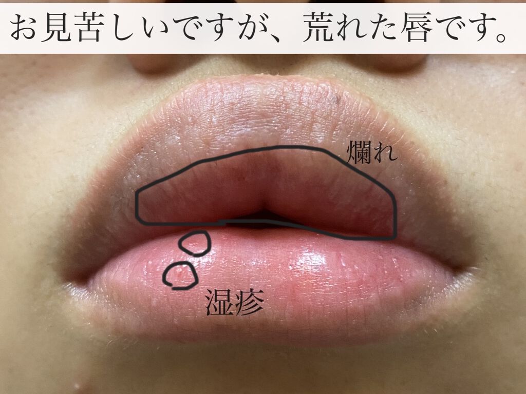 シュミテクト やさしく ホワイトニング/シュミテクト/歯磨き粉を使ったクチコミ（3枚目）