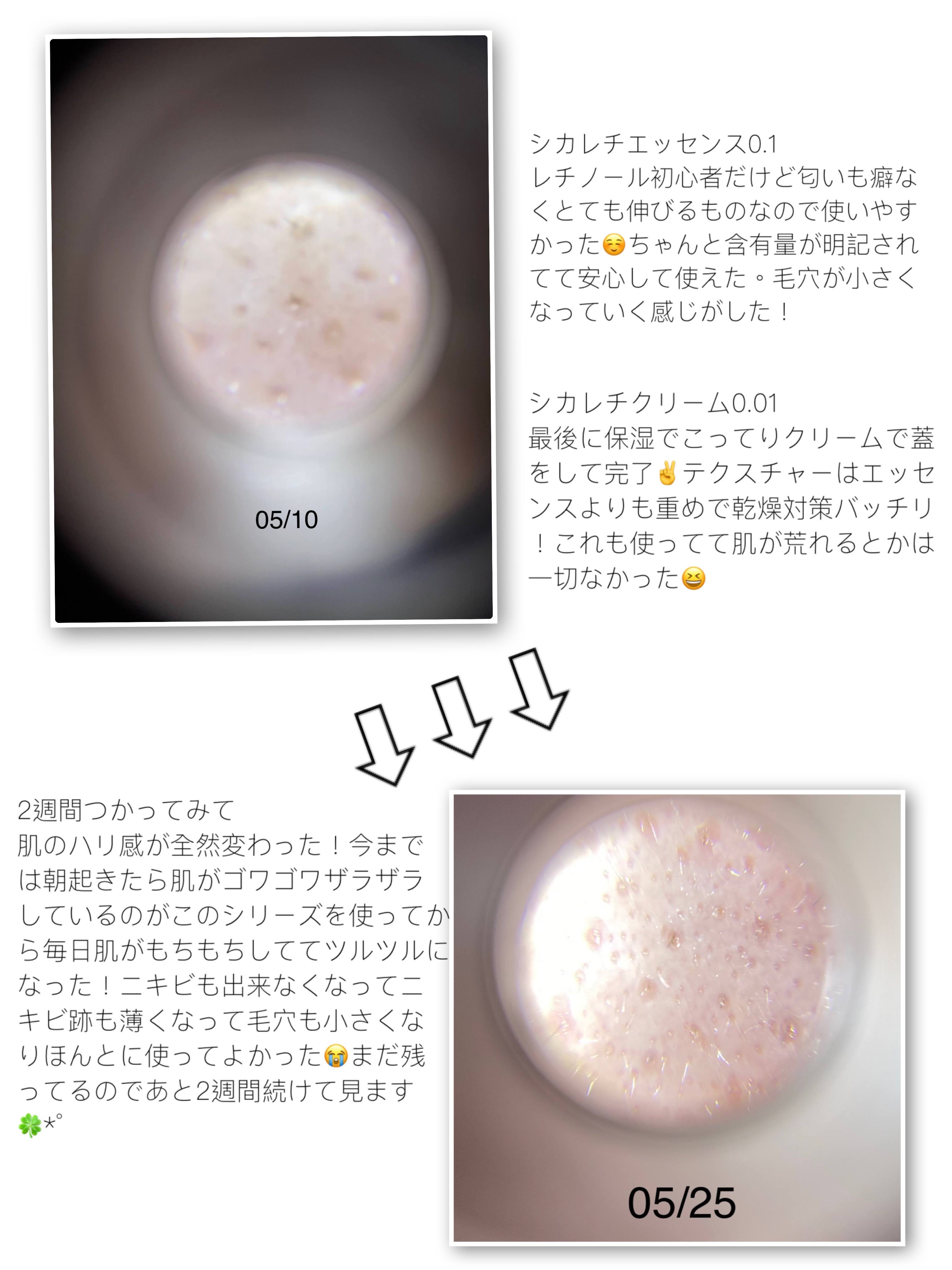 【使った商品】リードルショット シカレチエッセンス シカレチクリーム
 
【商品の特徴】マイクロ針 レチノール シカ
【使用感】ぴりぴり 
【良いところ】毛穴無くなる！
【イマイチなところ】なし！
【どんな人におすすめ？】ニキビ毛穴開き 気