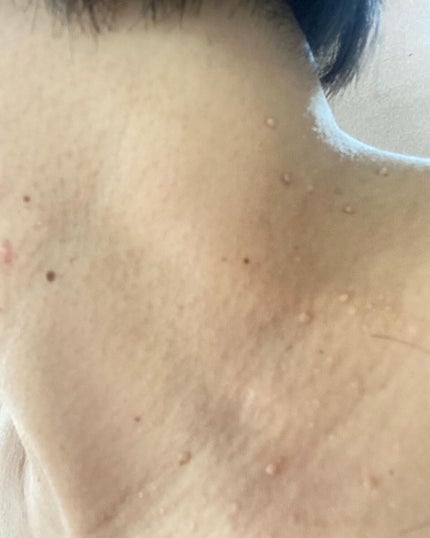 pikopiko on LIPS 「イボンヌクリーム TAゲッ!鏡を見るたび増えるのはシワだけじゃ..」(5枚目)