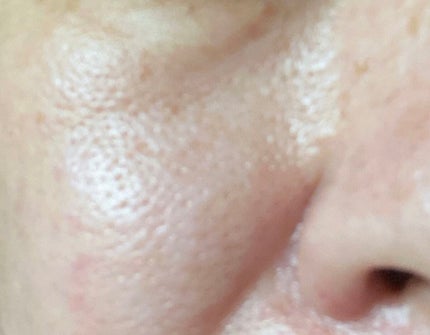 AC ピーリングソープ/NIKI PITA/洗顔石鹸を使ったクチコミ(5枚目)