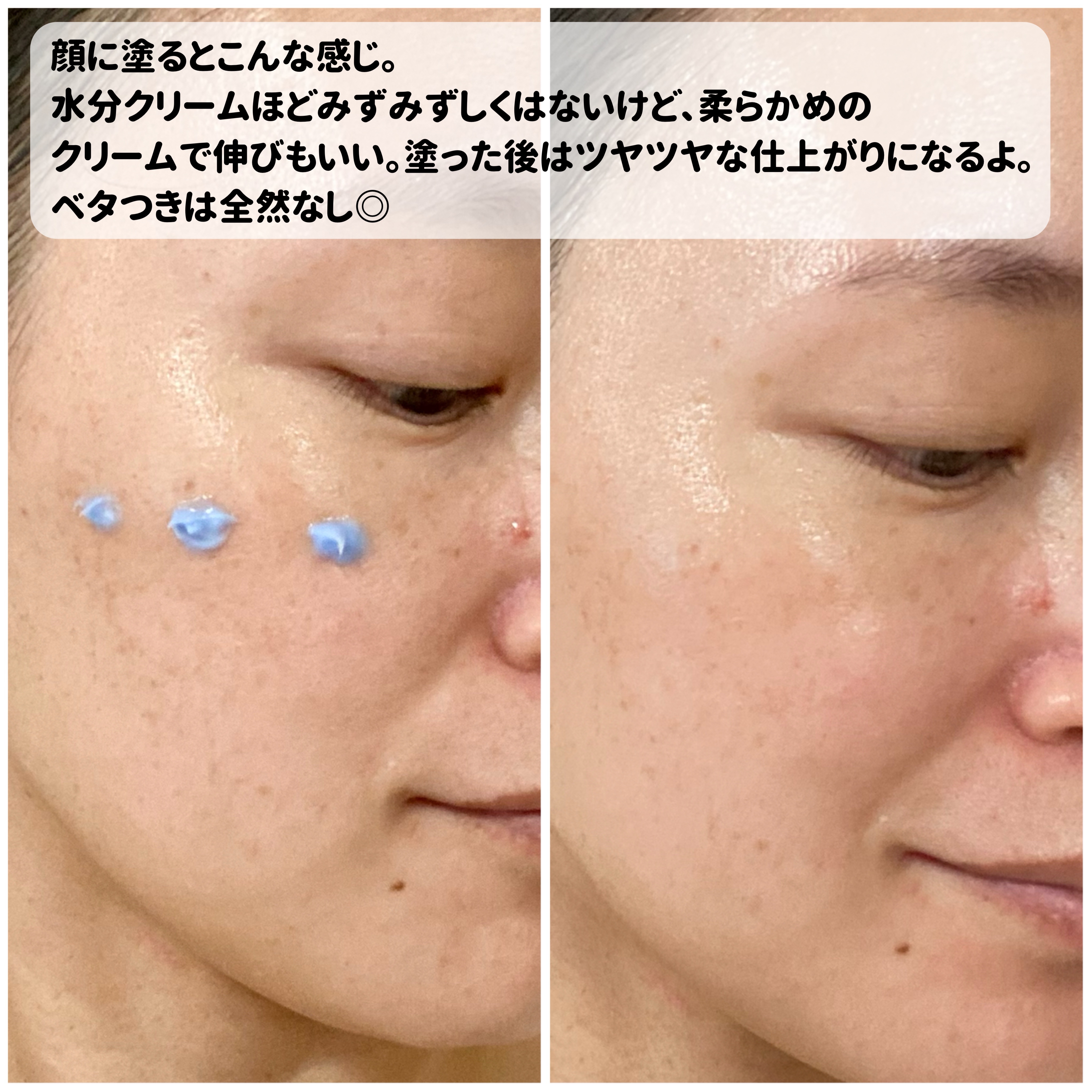 PHセンシティブスポットクリーム/SAM'U/フェイスクリームを使ったクチコミ（3枚目）