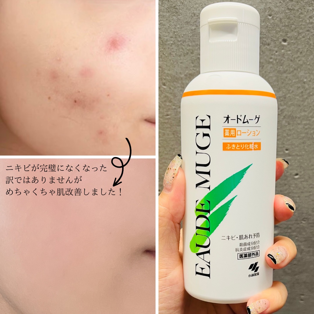 オードムーゲ 薬用ローション（ふきとり化粧水）｜オードムーゲ