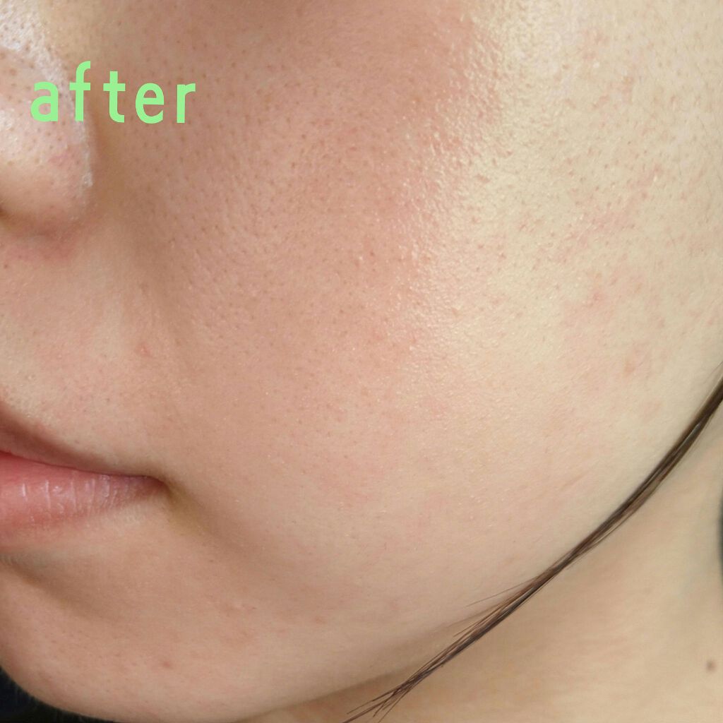 ローション/キュレル/ボディローションを使ったクチコミ(3枚目)