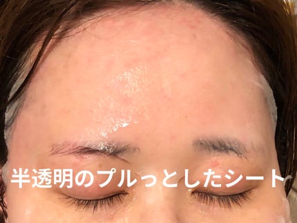 ティーツリーケア ソリューション エッセンシャルマスクEX/MEDIHEAL/シートマスク・パックを使ったクチコミ(3枚目)