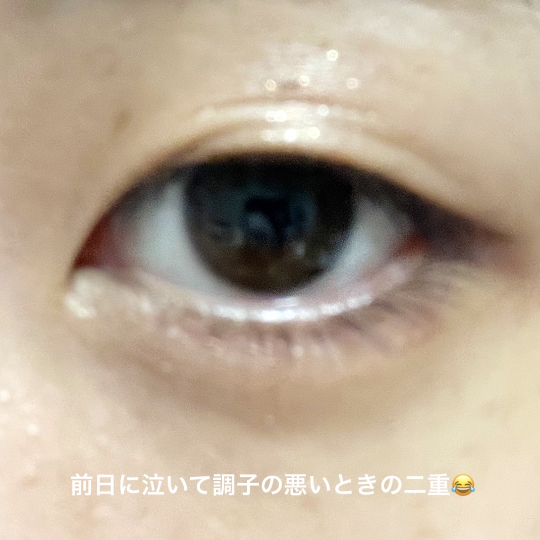 アイトーク 通常版/アイトーク/二重まぶた用アイテムを使ったクチコミ（2枚目）