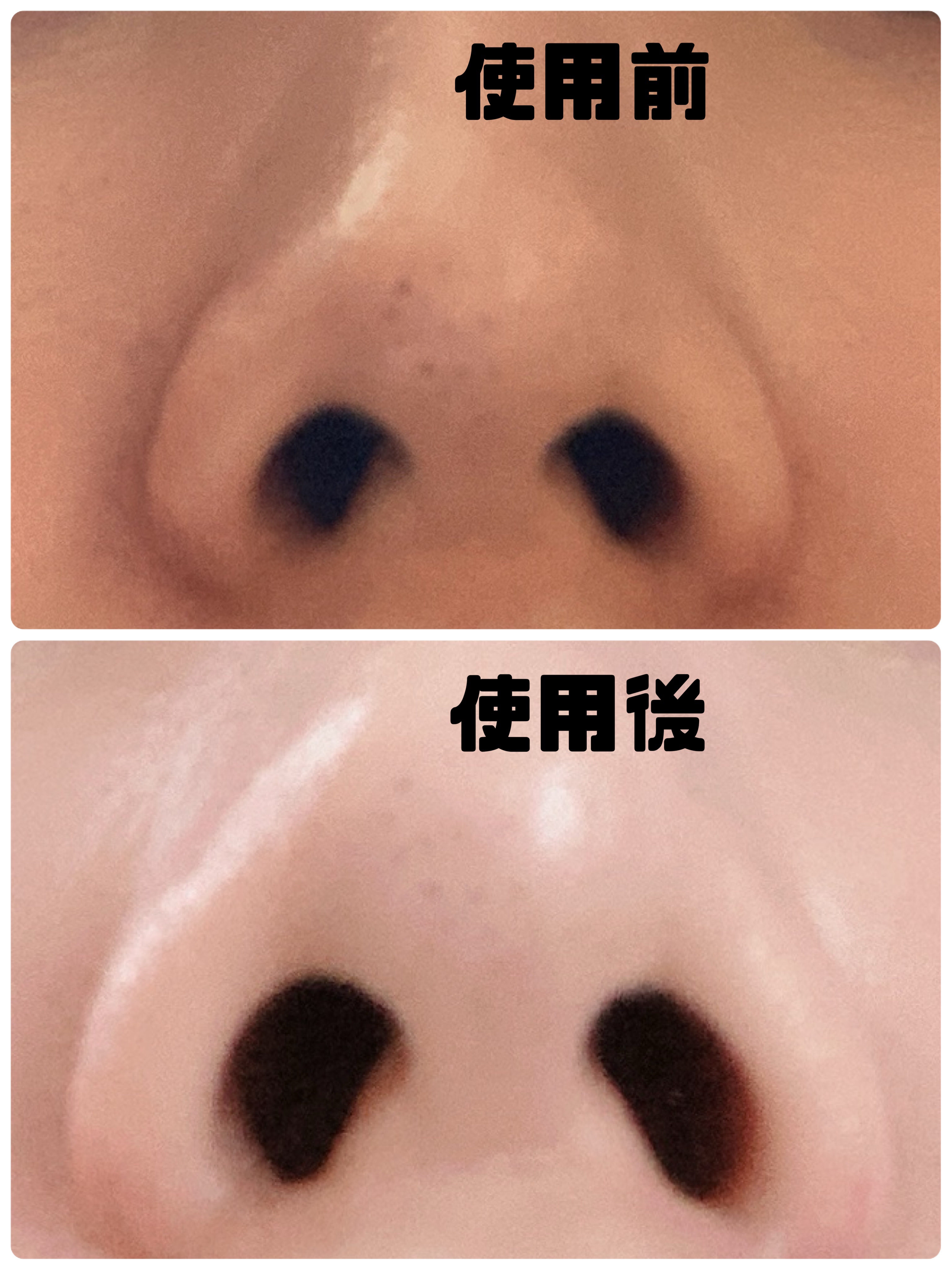 マイルドクレンジング オイル〈ブラック＆スムース〉/ファンケル/オイルクレンジングを使ったクチコミ（2枚目）