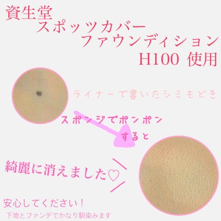 スポッツカバー ファウンデイション/SHISEIDO/クリームコンシーラーを使ったクチコミ(1枚目)