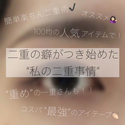 二重まぶた用シール/DAISO/二重まぶた用アイテムを使ったクチコミ(1枚目)