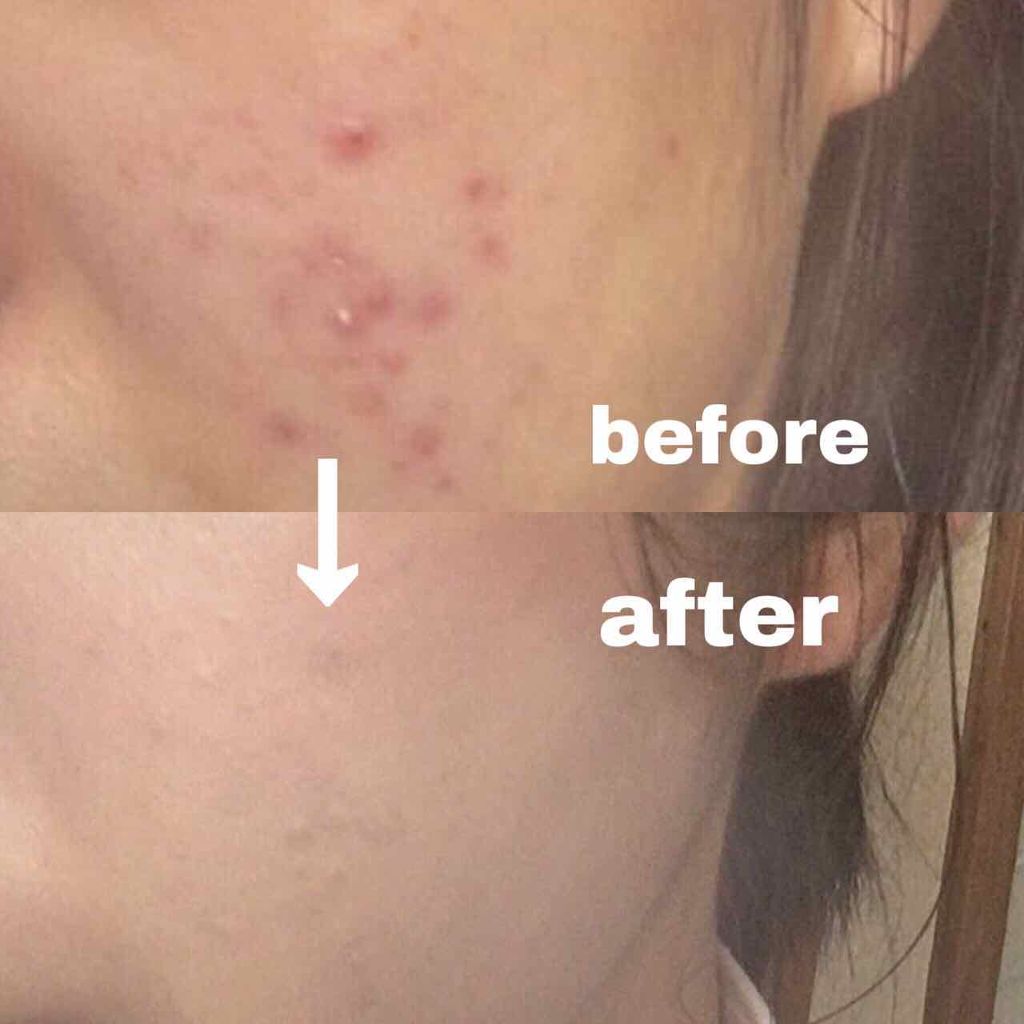 シークレットスキンメイカーゼロ(リキッド)/KATE/リキッドファンデーションを使ったクチコミ(2枚目)