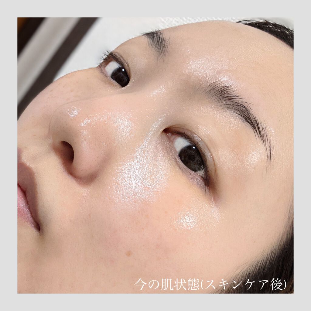 キャビアドットブースター/DEW/ブースター・導入液を使ったクチコミ（2枚目）