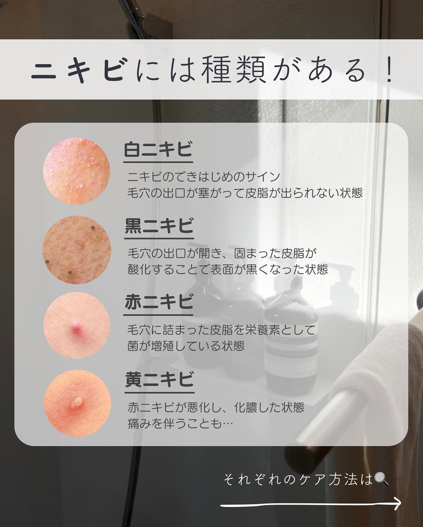 ニキビ治療薬(医薬品)/メンソレータム アクネス/その他を使ったクチコミ(4枚目)