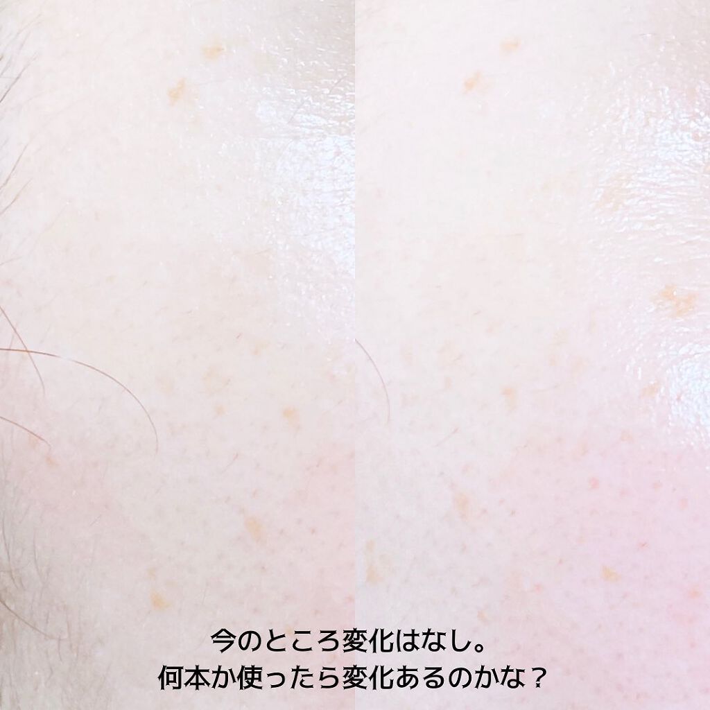 ビハククリア/安心健康ライフ/オールインワン化粧品を使ったクチコミ(5枚目)