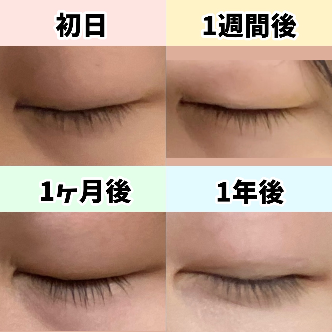 ローヤルゼリー配合 栄養ローション/DAISO/美容液を使ったクチコミ（3枚目）