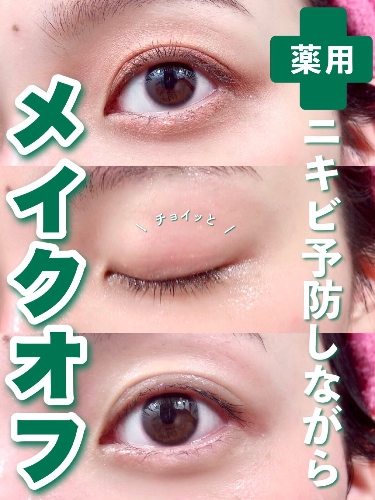 CHOIクレンジングオイル 薬用ニキビケア/肌美精/オイルクレンジングを使ったクチコミ(1枚目)