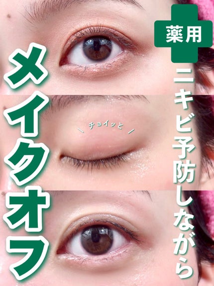 CHOIクレンジングオイル 薬用ニキビケア/肌美精/オイルクレンジングを使ったクチコミ(1枚目)