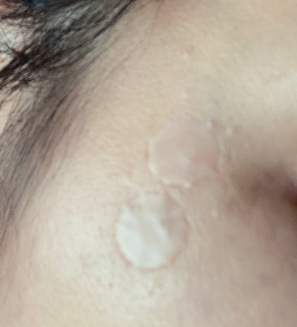 min on LIPS 「マスクによるお肌への影響💦擦れや乾燥。お肌へのストレス。ニキパ..」(7枚目)