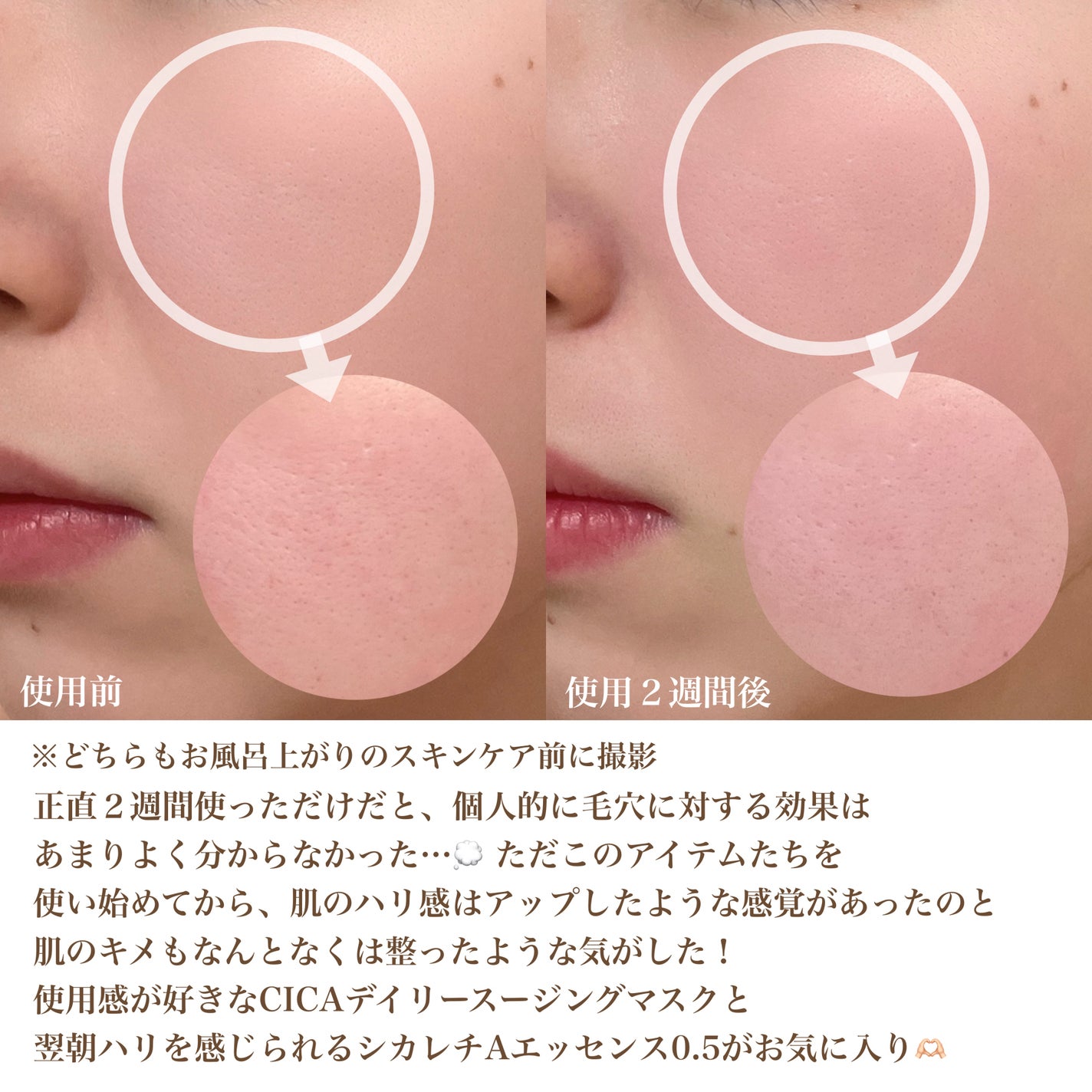 CICA デイリースージングマスク/VT/シートマスク・パックを使ったクチコミ(10枚目)