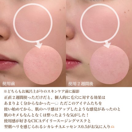 CICA デイリースージングマスク/VT/シートマスク・パックを使ったクチコミ(10枚目)