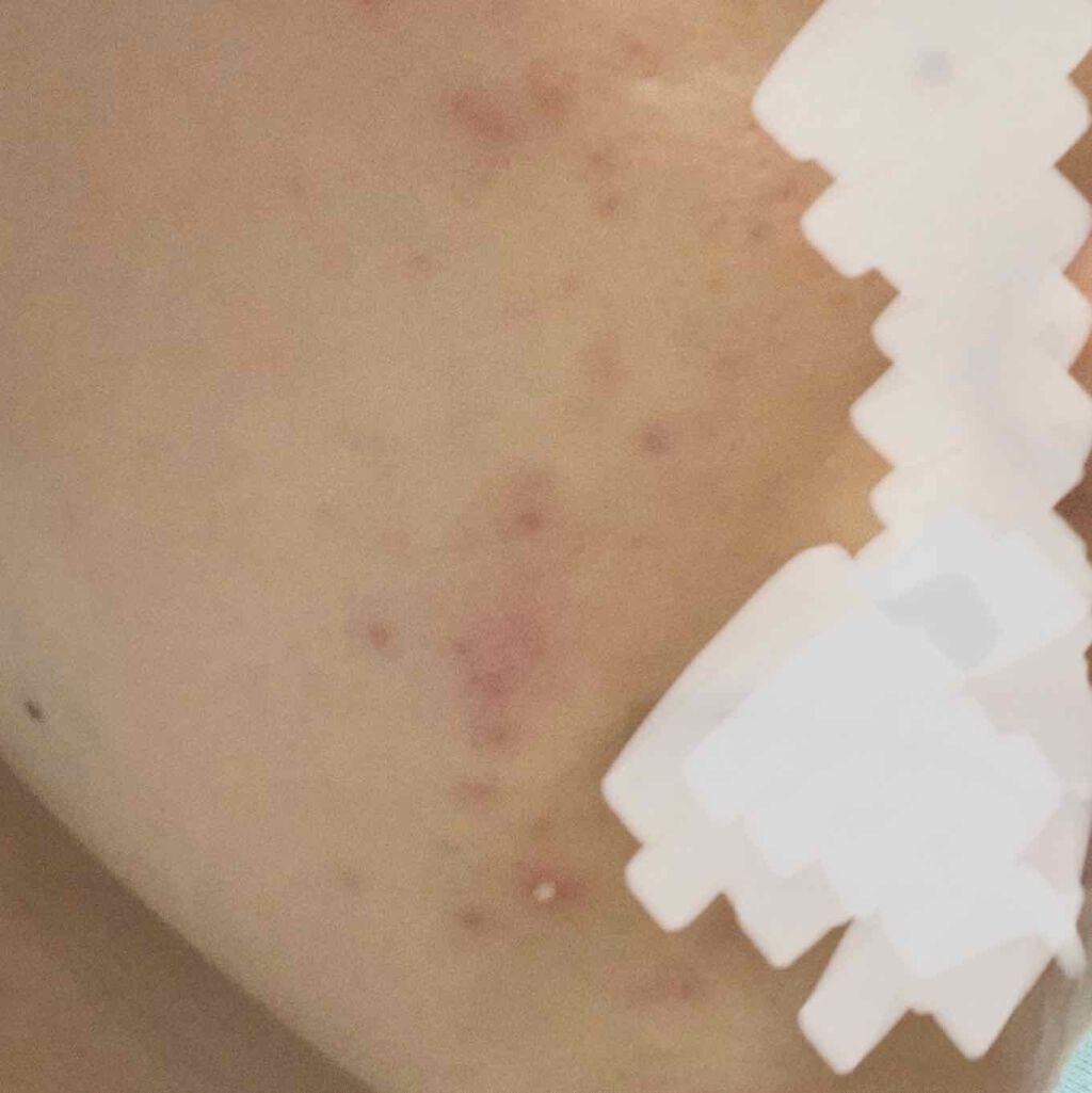 QuSomeモイスチャーリッチクリーム/b.glen/フェイスクリームを使ったクチコミ(2枚目)