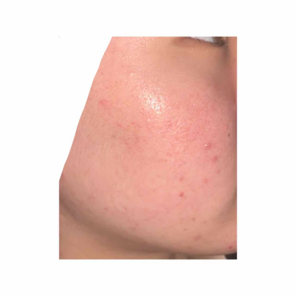 化粧水/なめらか本舗/化粧水を使ったクチコミ（3枚目）